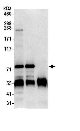 Immunoprecipitation:GGA1 AntibodyNBP3-30196] -Detection of human GGA1 by western blot of immunoprecipitates. Samples: Whole cell lysate (0.5 or 1.0 mg per IP reaction; 20% of IP loaded) from 293T cells prepared using NETN lysis buffer. Antibodies: Affinity purified rabbit anti-GGA1 antibody NBP3-30196 (lot NBP3-30196-1) used for IP at 6 µg per reaction. GGA1 was also immunoprecipitated by rabbit anti-GGA1.. For blotting immunoprecipitated GGA1, NBP3-30196 was used at 0.4 µg/ml. Detection: Chemiluminescence with an exposure time of 10 seconds.