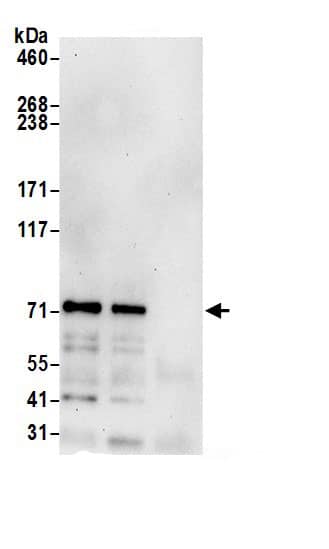 Immunoprecipitation:GGA1 AntibodyNBP3-30197] -Detection of human GGA1 by western blot of immunoprecipitates. Samples: Whole cell lysate (0.5 or 1.0 mg per IP reaction; 20% of IP loaded) from 293T cells prepared using NETN lysis buffer. Antibodies: Affinity purified rabbit anti-GGA1 antibody NBP3-30197 (lot NBP3-30197-1) used for IP at 6 µg per reaction. GGA1 was also immunoprecipitated by rabbit anti-GGA1 antibody for blotting immunoprecipitated GGA1, NBP3-30197 was used at 0.4 µg/ml. Detection: Chemiluminescence with an exposure time of 30 seconds.