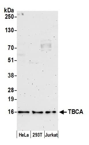 Western Blot:[NBP3-30200]-Detection of human TBCA by western blot. Samples: Whole cell lysate from HeLa, HEK293T, and Jurkat cells prepared using NETN lysis buffer. Antibody: Affinity purified rabbit antibody used for WB at 0. 1 µg/ml. Detection: Chemiluminescence with an exposure time of 3 minutes.