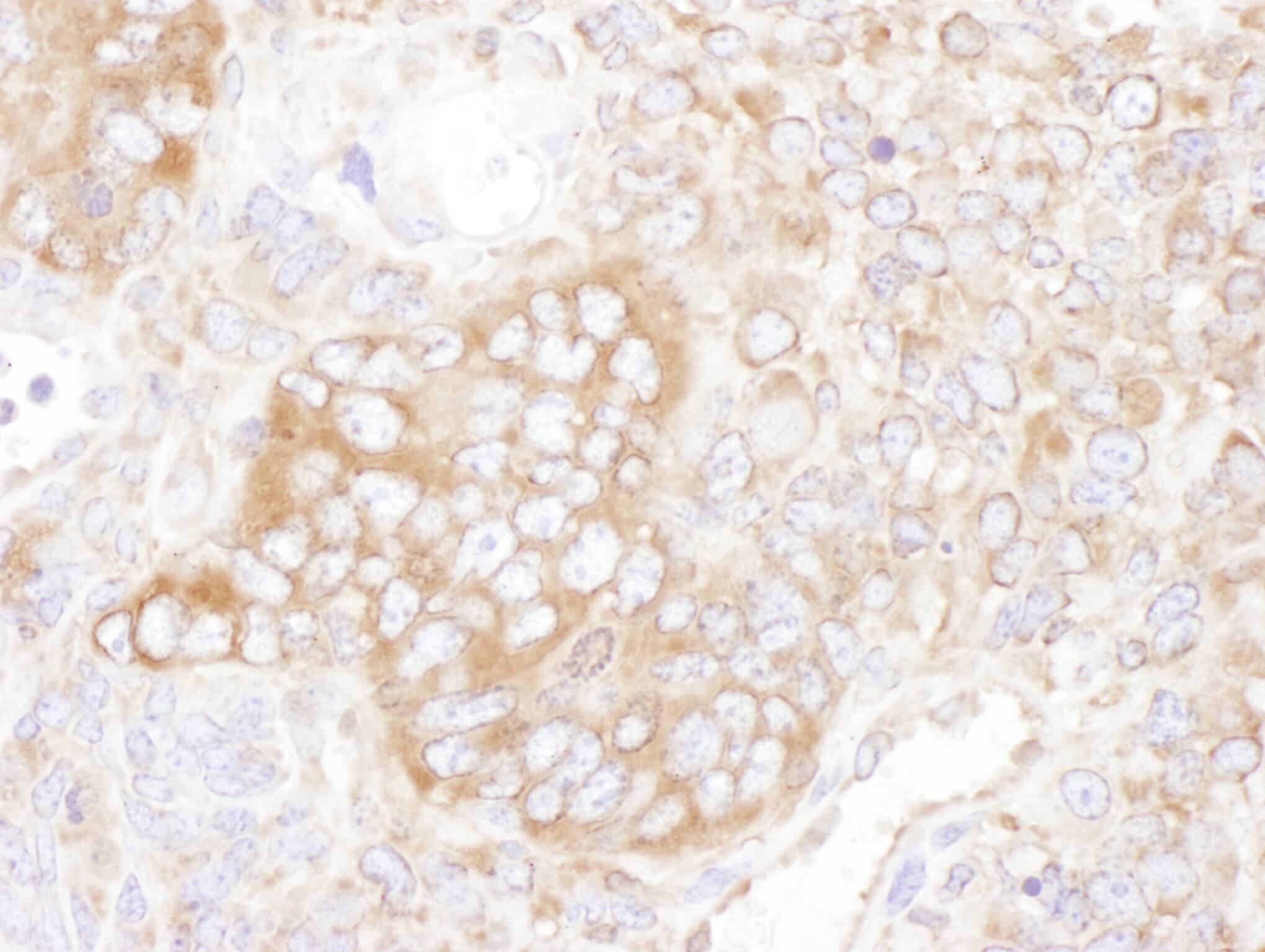 Immunohistochemistry:[NBP3-30203]-Detection of mouse YB1 by immunohistochemistry. Sample: FFPE section of mouse teratoma. Antibody: Affinity purified rabbit anti-YB1 used at a dilution of 1: 1,000. Detection: DAB