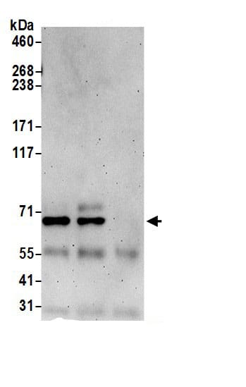 Immunoprecipitation:DUS3L AntibodyNBP3-30206] -Detection of human DUS3L by western blot of immunoprecipitates. Samples: Whole cell lysate (0.5 or 1.0 mg per IP reaction; 20% of IP loaded) from 293T cells prepared using NETN lysis buffer. Antibodies: Affinity purified rabbit anti-DUS3L antibody NBP3-30206 (lot NBP3-30206-1) used for IP at 6 µg per reaction. DUS3L was also immunoprecipitated by rabbit anti-DUS3L antibody for blotting immunoprecipitated DUS3L, NBP3-30206 was used at 1 µg/ml. Detection: Chemiluminescence with an exposure time of 3 minutes.