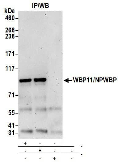 Immunoprecipitation:[NBP3-30207]-Detection of human WBP11/NPWBP by western blot of immunoprecipitates. Samples: Whole cell lysate from HeLa cells prepared using NETN lysis buffer. Antibody: Affinity purified rabbit anti-WBP11/NPWBP antibody used for IP at 6 µg per reaction. WBP11/NPWBP was also immunoprecipitated by rabbit anti-WBP11/NPWBP antibody. For blotting immunoprecipitated WBP11/NPWBP, was used at 1 µg/ml. Detection: Chemiluminescence with an exposure time of 3 minutes.