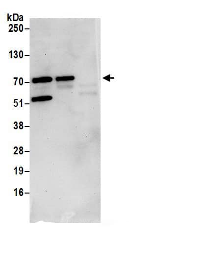 Immunoprecipitation:SLX4 Interacting Protein AntibodyNBP3-30208] -Detection of human SLX4IP/C20orf94 by western blot of immunoprecipitates. Samples: Whole cell lysate (0.5 or 1.0 mg per IP reaction; 20% of IP loaded) from HeLa cells prepared using NETN lysis buffer. Antibodies: Affinity purified rabbit anti-SLX4IP/C20orf94 antibody NBP3-30208 (lot NBP3-30208-1) used for IP at 6 µg per reaction. SLX4IP/C20orf94 was also immunoprecipitated by rabbit anti-SLX4IP/C20orf94.. For blotting immunoprecipitated SLX4IP/C20orf94, A304-994A was used at 1 µg/ml. Detection: Chemiluminescence with an exposure time of 30 seconds.