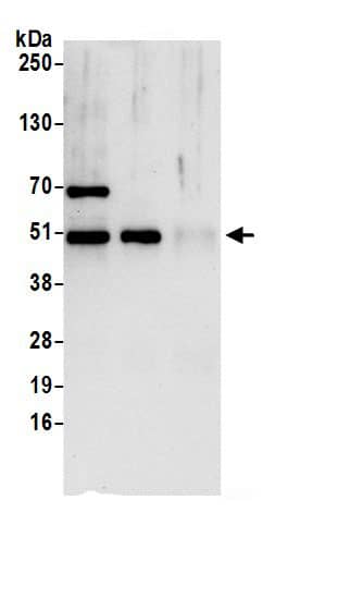 Immunoprecipitation:Nesfatin-1/Nucleobindin-2 AntibodyNBP3-30209] -Detection of human NUCB2 by western blot of immunoprecipitates. Samples: Whole cell lysate (0.5 or 1.0 mg per IP reaction; 20% of IP loaded) from Jurkat cells prepared using NETN lysis buffer. Antibodies: Affinity purified rabbit anti-NUCB2 antibody NBP3-30209 (lot NBP3-30209-1) used for IP at 6 µg per reaction. NUCB2 was also immunoprecipitated by rabbit anti-NUCB2.. For blotting immunoprecipitated NUCB2, NBP3-30209 was used at 1 µg/ml. Detection: Chemiluminescence with an exposure time of 10 seconds.