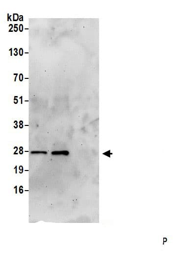 Immunoprecipitation:PRTFDC1 AntibodyNBP3-30210] -Detection of human PRTFDC1 by western blot of immunoprecipitates. Samples: Whole cell lysate (0.5 or 1.0 mg per IP reaction; 20% of IP loaded) from 293T cells prepared using NETN lysis buffer. Antibodies: Affinity purified rabbit anti-PRTFDC1 antibody (NBP3-30210 lot 1) used for IP at 6 µg per reaction. PRTFDC1 was also immunoprecipitated by rabbit anti-PRTFDC1 antibody. For blotting immunoprecipitated PRTFDC1, NBP3-30210 was used at 0.4 mg/ml. Detection: Chemiluminescence with an exposure time of 75 seconds.