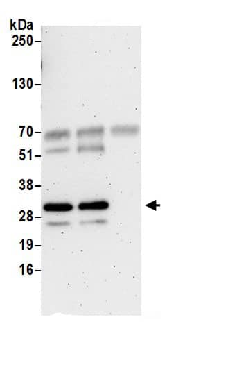 Immunoprecipitation:C2orf49 AntibodyNBP3-30211] -Detection of human C2orf49 by western blot of immunoprecipitates. Samples: Whole cell lysate (0.5 or 1.0 mg per IP reaction; 20% of IP loaded) from 293T cells prepared using NETN lysis buffer. Antibodies: Affinity purified rabbit anti-C2orf49 antibody NBP3-30211 (lot NBP3-30211-1) used for IP at 6 µg per reaction. C2orf49 was also immunoprecipitated by rabbit anti-C2orf49 antibody. For blotting immunoprecipitated C2orf49, NBP3-30211 was used at 0.4 µg/ml. Detection: Chemiluminescence with an exposure time of 3 minutes.
