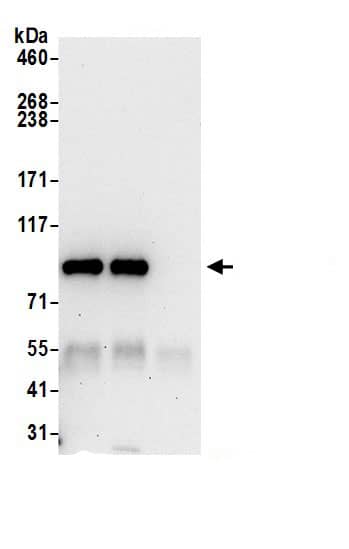 Immunoprecipitation:PLA2G4A AntibodyNBP3-30212] -Detection of human PLA2G4A by western blot of immunoprecipitates. Samples: Whole cell lysate (0.5 or 1.0 mg per IP reaction; 20% of IP loaded) from HeLa cells prepared using NETN lysis buffer. Antibodies: Affinity purified rabbit anti-PLA2G4A antibody NBP3-30212 (lot NBP3-30212-1) used for IP at 6 µg per reaction. PLA2G4A was also immunoprecipitated by rabbit anti-PLA2G4A.. For blotting immunoprecipitated PLA2G4A, NBP3-30212 was used at 1 µg/ml. Detection: Chemiluminescence with an exposure time of 30 seconds.