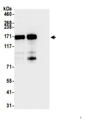 Immunoprecipitation:KDM6A AntibodyNBP3-30213] -Detection of human UTX by western blot of immunoprecipitates. Samples: Whole cell lysate (1.0 mg per IP reaction; 20% of IP loaded) from LNCaP, HEK293T, Jurkat, TCMK-1, and NIH 3T3 cells prepared using NETN lysis buffer. Antibodies: Affinity purified rabbit anti-UTX antibody NBP3-30213 (lot NBP3-30213-4) used for IP at 6 µg per reaction. UTX was also immunoprecipitated by a previous lot of this antibody (lot NBP3-30213-3). For blotting immunoprecipitated UTX, NBP3-30213 was used at 0.1 µg/ml. Detection: Chemiluminescence with an exposure time of 30 seconds.