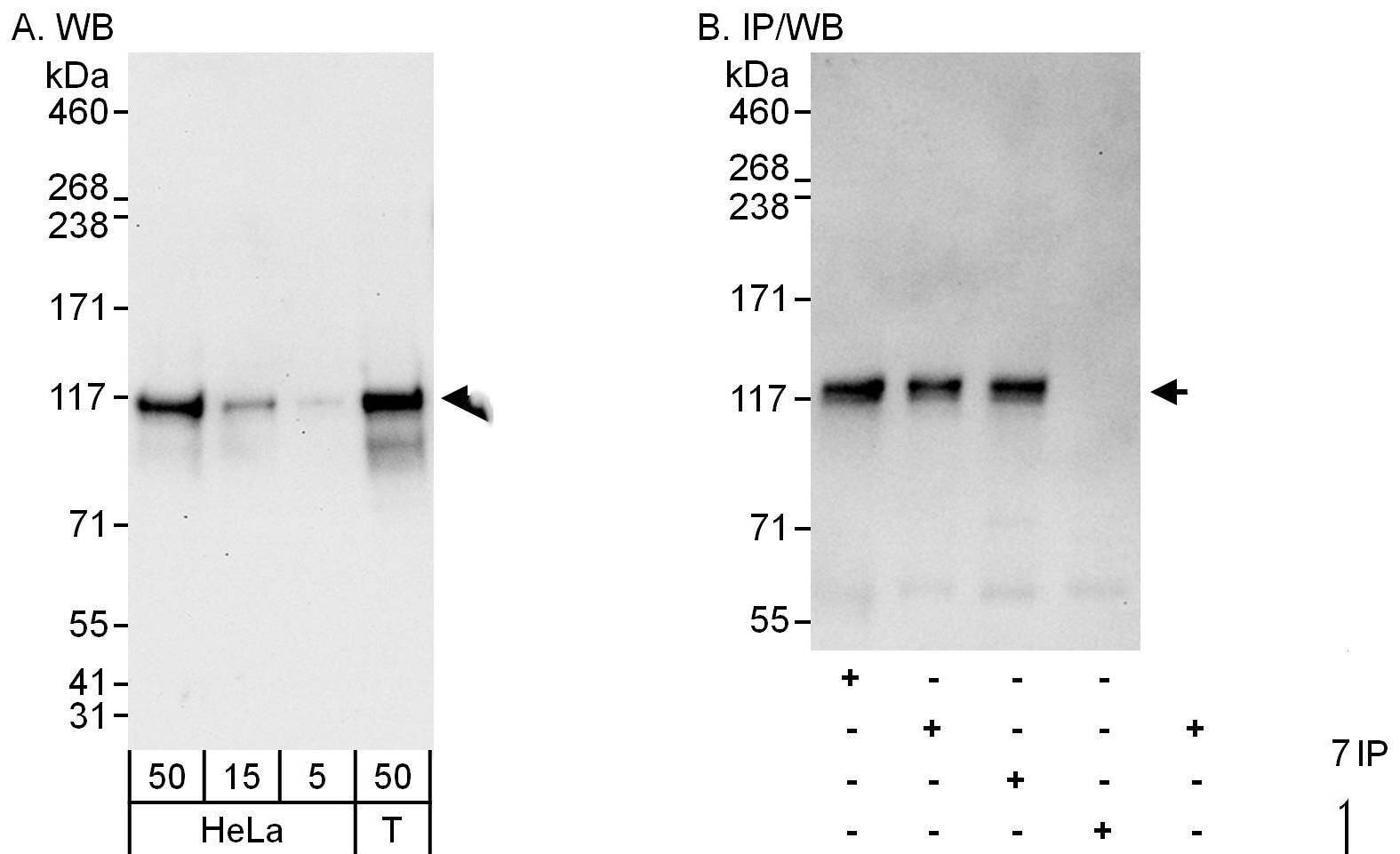 Western Blot:[NBP3-30214]-Detection of human ANKLE2 by western blot and immunoprecipitation. Samples: Whole cell lysate from HeLa and HEK293T cells. Antibodies: Affinity purified rabbit anti-ANKLE2 antibody used for WB at 0. 04 µg/ml and 1 µg/ml and used for IP at 3 µg/mg lysate. ANKLE2 was also immunoprecipitated by rabbit anti-ANKLE2 antibodies and , which recognize downstream epitopes. Detection: Chemiluminescence with exposure times of 30 seconds and 10 seconds.