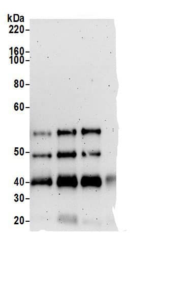 Immunoprecipitation:FGD3 AntibodyNBP3-30215] -Detection of human FGD3 by western blot of immunoprecipitates. Samples: Whole cell lysate (0.5 or 1.0 mg per IP reaction; 20% of IP loaded) from HeLa cells prepared using NETN lysis buffer. Antibodies: Affinity purified rabbit anti-FGD3 antibody NBP3-30215 (lot NBP3-30215-1) used for IP at 6 µg per reaction. FGD3 was also immunoprecipitated by rabbit anti-FGD3 antibodies. For blotting immunoprecipitated FGD3, NBP3-30215 was used at 1 µg/ml. Detection: Chemiluminescence with an exposure time of 3 minutes.