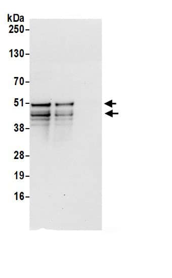 Immunoprecipitation:Cyclin A2 AntibodyNBP3-30216] -Detection of human CCNA2 by western blot of immunoprecipitates. Samples: Whole cell lysate (0.5 or 1.0 mg per IP reaction; 20% of IP loaded) from Jurkat cells prepared using NETN lysis buffer. Antibodies: Affinity purified rabbit anti-CCNA2 antibody NBP3-30216 (lot NBP3-30216-1) used for IP at 6 µg per reaction. CCNA2 was also immunoprecipitated by rabbit anti-CCNA2.. For blotting immunoprecipitated CCNA2, NBP3-30216 was used at 0.4 µg/ml. Detection: Chemiluminescence with an exposure time of 10 seconds.