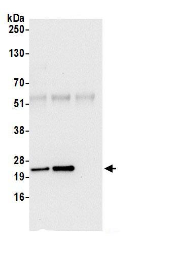 Immunoprecipitation:ATP5H AntibodyNBP3-30218] -Detection of human ATP5H by western blot of immunoprecipitates. Samples: Whole cell lysate (0.5 or 1.0 mg per IP reaction; 20% of IP loaded) from 293T cells prepared using NETN lysis buffer. Antibodies: Affinity purified rabbit anti-ATP5H antibody NBP3-30218 (lot NBP3-30218-1) used for IP at 6 µg per reaction. ATP5H was also immunoprecipitated by rabbit anti-ATP5H.. For blotting immunoprecipitated ATP5H, NBP3-30218 was used at 1 µg/ml. Detection: Chemiluminescence with an exposure time of 10 seconds.