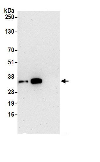 Immunoprecipitation:SRM AntibodyNBP3-30219] -Detection of human SRM by western blot of immunoprecipitates. Samples: Whole cell lysate (0.5 or 1.0 mg per IP reaction; 20% of IP loaded) from 293T cells prepared using NETN lysis buffer. Antibodies: Affinity purified rabbit anti-SRM antibody NBP3-30219 (lot NBP3-30219-1) used for IP at 6 µg per reaction. SRM was also immunoprecipitated by rabbit anti-SRM.. For blotting immunoprecipitated SRM, NBP3-30219 was used at 0.4 µg/ml. Detection: Chemiluminescence with an exposure time of 3 minutes.