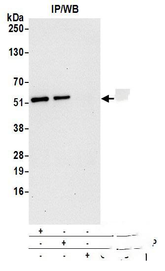 Immunoprecipitation:[NBP3-30220]-Detection of human CNDP2 by western blot of immunoprecipitates. Samples: Whole cell lysate from 293T cells prepared using NETN lysis buffer. Antibodies: Affinity purified rabbit anti-CNDP2 antibody used for IP at 6 µg per reaction. CNDP2 was also immunoprecipitated by rabbit anti-CNDP2 antibody. For blotting immunoprecipitated CNDP2, was used at 1 µg/ml. Detection: Chemiluminescence with an exposure time of 30 seconds.
