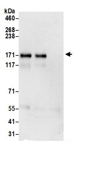 Immunoprecipitation:PTK7/CCK4 AntibodyNBP3-30221] -Detection of human PTK7 by western blot of immunoprecipitates. Samples: Whole cell lysate (1 mg for IP; 20% of IP loaded) prepared using NETN buffer from Jurkat cells. Antibodies: Affinity purified rabbit anti-PTK7 antibody NBP3-30221 (lot NBP3-30221-1) used for IP at 6 µg per reaction. PTK7 was also immunoprecipitated by rabbit anti-PTK7.. For blotting immunoprecipitated PTK7, NBP3-30221 was used at 1 µg/ml. Detection: Chemiluminescence with an exposure time of 30 seconds.