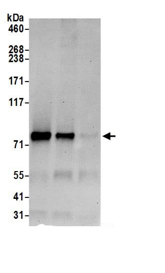 Immunoprecipitation:SEC63 AntibodyNBP3-30222] -Detection of human SEC63 by western blot of immunoprecipitates. Samples: Whole cell lysate (0.5 or 1.0 mg per IP reaction; 20% of IP loaded) from HeLa cells prepared using NETN lysis buffer. Antibodies: Affinity purified rabbit anti-SEC63 antibody NBP3-30222 (lot NBP3-30222-1) used for IP at 6 µg per reaction. SEC63 was also immunoprecipitated by rabbit anti-SEC63 antibody BL19995. For blotting immunoprecipitated SEC63, NBP3-30222 was used at 0.4 µg/ml. Detection: Chemiluminescence with an exposure time of 30 seconds.