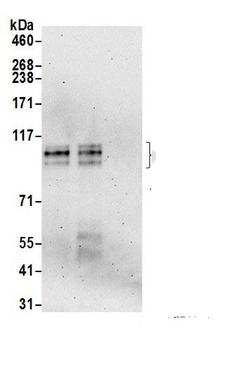 Immunoprecipitation:ARHGAP4 AntibodyNBP3-30223] -Detection of human ARHGAP4 by western blot of immunoprecipitates. Samples: Whole cell lysate (0.5 or 1.0 mg per IP reaction; 20% of IP loaded) from Jurkat cells prepared using NETN lysis buffer. Antibodies: Affinity purified rabbit anti-ARHGAP4 antibody NBP3-30223 (lot NBP3-30223-1) used for IP at 6 µg per reaction. ARHGAP4 was also immunoprecipitated by rabbit anti-ARHGAP4.. For blotting immunoprecipitated ARHGAP4, NBP3-30223 was used at 0.4 µg/ml. Detection: Chemiluminescence with an exposure time of 3 minutes.