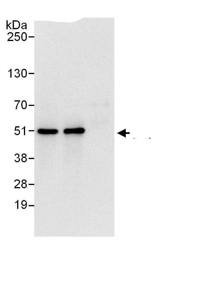 Immunoprecipitation:Tbp7 AntibodyNBP3-30225] -Detection of human PSMC4 by western blot of immunoprecipitates. Samples: Whole cell lysate (1 mg for IP; 20% of IP loaded) from HEK293T cells. Antibodies: Affinity purified rabbit anti-PSMC4 antibody NBP3-30225 (lot NBP3-30225-1) used for IP at 6 µg/mg lysate. PSMC4 was also immunoprecipitated by rabbit anti-PSMC4.. For blotting immunoprecipitated PSMC4, NBP3-30225 was used at 1 µg/ml. Detection: Chemiluminescence with an exposure time of 3 seconds.