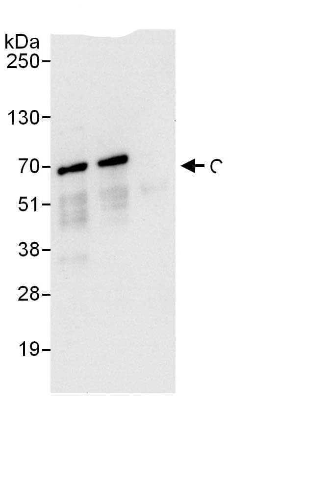 Immunoprecipitation:CARF/CDKN2AIP AntibodyNBP3-30229] -Detection of human CARF by western blot of immunoprecipitates. Samples: Whole cell lysate (1 mg for IP; 20% of IP loaded) from HEK293T cells. Antibodies: Affinity purified rabbit anti-CARF antibody NBP3-30229 (lot NBP3-30229-1) used for IP at 6 µg/mg lysate. CARF was also immunoprecipitated by rabbit anti-CARF.. For blotting immunoprecipitated CARF, NBP3-30229 was used at 1 µg/ml. Detection: Chemiluminescence with an exposure time of 10 seconds.