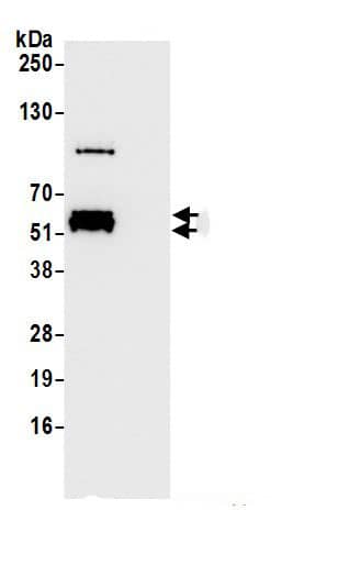 Immunoprecipitation:ZNF207 AntibodyNBP3-30230] -Detection of human ZNF207 by western blot of immunoprecipitates. Samples: Whole cell lysate (1.0 mg per IP reaction; 20% of IP loaded) from HEK293T cells prepared using NETN lysis buffer. Antibodies: Affinity purified rabbit anti-ZNF207 antibody (NBP3-30230 lot 1) used for IP at 1 µg per reaction. For blotting immunoprecipitated ZNF207, NBP3-30230 was used at 0.04 mg/ml. Detection: Chemiluminescence with an exposure time of 1 second.