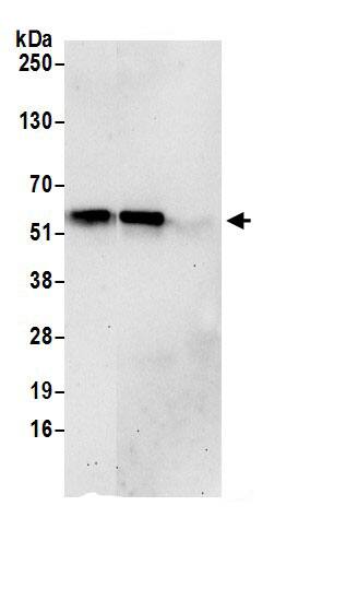 Immunoprecipitation:PUS3 AntibodyNBP3-30232] -Detection of human PUS3 by western blot of immunoprecipitates. Samples: Whole cell lysate (0.5 or 1.0 mg per IP reaction; 20% of IP loaded) from 293T cells prepared using NETN lysis buffer. Antibodies: Affinity purified rabbit anti-PUS3 antibody NBP3-30232 (lot NBP3-30232-1) used for IP at 6 µg per reaction. PUS3 was also immunoprecipitated by rabbit anti-PUS3.. For blotting immunoprecipitated PUS3, NBP3-30232 was used at 1 µg/ml. Detection: Chemiluminescence with an exposure time of 30 seconds.
