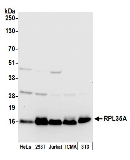 Western Blot RPL35A Antibody