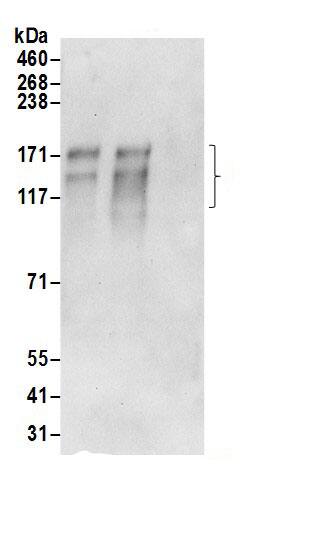 Immunoprecipitation:AE2 AntibodyNBP3-30239] -Detection of human AE2 by western blot of immunoprecipitates. Samples: Whole cell lysate (0.5 or 1.0 mg per IP reaction; 20% of IP loaded) from 293T cells prepared using RIPA lysis buffer. Antibodies: Affinity purified rabbit anti-AE2 antibody NBP3-30239 (lot NBP3-30239-1) used for IP at 6 µg per reaction. AE2 was also immunoprecipitated by rabbit anti-AE2.. For blotting immunoprecipitated AE2, NBP3-30239 was used at 1 µg/ml. Detection: Chemiluminescence with an exposure time of 30 seconds.