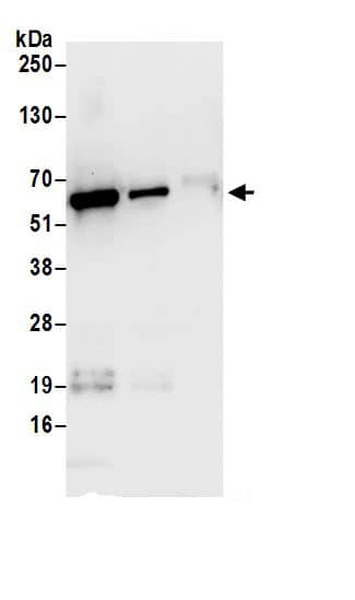 Immunoprecipitation:CAP1 AntibodyNBP3-30240] -Detection of human CAP1 by western blot of immunoprecipitates. Samples: Whole cell lysate (0.5 or 1.0 mg per IP reaction; 20% of IP loaded) from 293T cells prepared using NETN lysis buffer. Antibodies: Affinity purified rabbit anti-CAP1 antibody NBP3-30240 (lot NBP3-30240-1) used for IP at 6 µg per reaction. CAP1 was also immunoprecipitated by rabbit anti-CAP1 antibody for blotting immunoprecipitated CAP1, NBP3-30240 was used at 1 µg/ml. Detection: Chemiluminescence with an exposure time of 30 seconds.