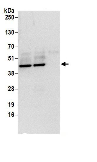 Immunoprecipitation:NUDC AntibodyNBP3-30241] -Detection of human NUDC by western blot of immunoprecipitates. Samples: Whole cell lysate (0.5 or 1.0 mg per IP reaction; 20% of IP loaded) from 293T cells prepared using NETN lysis buffer. Antibodies: Affinity purified rabbit anti-NUDC antibody NBP3-30241 (lot NBP3-30241-1) used for IP at 6 µg per reaction. NUDC was also immunoprecipitated by rabbit anti-NUDC antibody BL17120. For blotting immunoprecipitated NUDC, NBP3-30241 was used at 1 µg/ml. Detection: Chemiluminescence with an exposure time of 3 seconds.