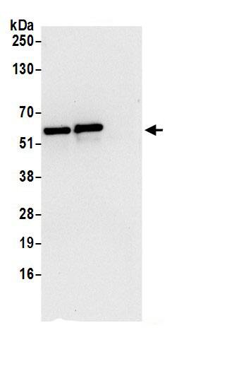 Immunoprecipitation:CCDC47 AntibodyNBP3-30245] -Detection of human CCDC47 by western blot of immunoprecipitates. Samples: Whole cell lysate (0.5 or 1.0 mg per IP reaction; 20% of IP loaded) from 293T cells prepared using NETN lysis buffer. Antibodies: Affinity purified rabbit anti-CCDC47 antibody NBP3-30245 (lot NBP3-30245-1) used for IP at 6 µg per reaction. CCDC47 was also immunoprecipitated by rabbit anti-CCDC47.. For blotting immunoprecipitated CCDC47, NBP3-30245 was used at 0.4 µg/ml. Detection: Chemiluminescence with an exposure time of 10 seconds.