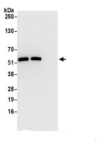 Immunoprecipitation:GSDMDC1 AntibodyNBP3-30246] -Detection of human GSDMD by western blot of immunoprecipitates. Samples: Whole cell lysate (1.0 mg per IP reaction; 20% of IP loaded) from Jurkat cells prepared using NETN lysis buffer. Antibodies: Affinity purified rabbit anti-GSDMD antibody (NBP3-30246 lot 1) used for IP at 2 µg per reaction. GSDMD was also immunoprecipitated by rabbit anti-GSDMD.. For blotting immunoprecipitated GSDMD, NBP3-30246 was used at 0.1 mg/ml. Detection: Chemiluminescence with an exposure time of 30 seconds.