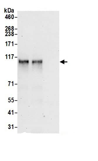 Immunoprecipitation:ZNF451 AntibodyNBP3-30250] -Detection of human ZNF451 by western blot of immunoprecipitates. Samples: Whole cell lysate (0.5 or 1.0 mg per IP reaction; 20% of IP loaded) from Jurkat cells prepared using NETN lysis buffer. Antibodies: Affinity purified rabbit anti-ZNF451 antibody NBP3-30250 (lot NBP3-30250-1) used for IP at 6 µg per reaction. ZNF451 was also immunoprecipitated by rabbit anti-ZNF451 antibody BL20399. For blotting immunoprecipitated ZNF451, NBP3-30250 was used at 0.4 µg/ml. Detection: Chemiluminescence with an exposure time of 30 seconds.