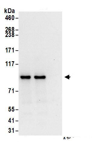 Immunoprecipitation:ASCC2 AntibodyNBP3-30254] -Detection of human ASCC2 by western blot of immunoprecipitates. Samples: Whole cell lysate (1 mg for IP; 20% of IP loaded) from HeLa cells. Antibodies: Affinity purified rabbit anti-ASCC2 antibody NBP3-30254 (lot NBP3-30254-1) used for IP at 6 µg/mg lysate. ASCC2 was also immunoprecipitated by rabbit anti-ASCC2.. For blotting immunoprecipitated ASCC2, NBP3-30254 was used at 1 µg/ml. Detection: Chemiluminescence with an exposure time of 10 seconds.