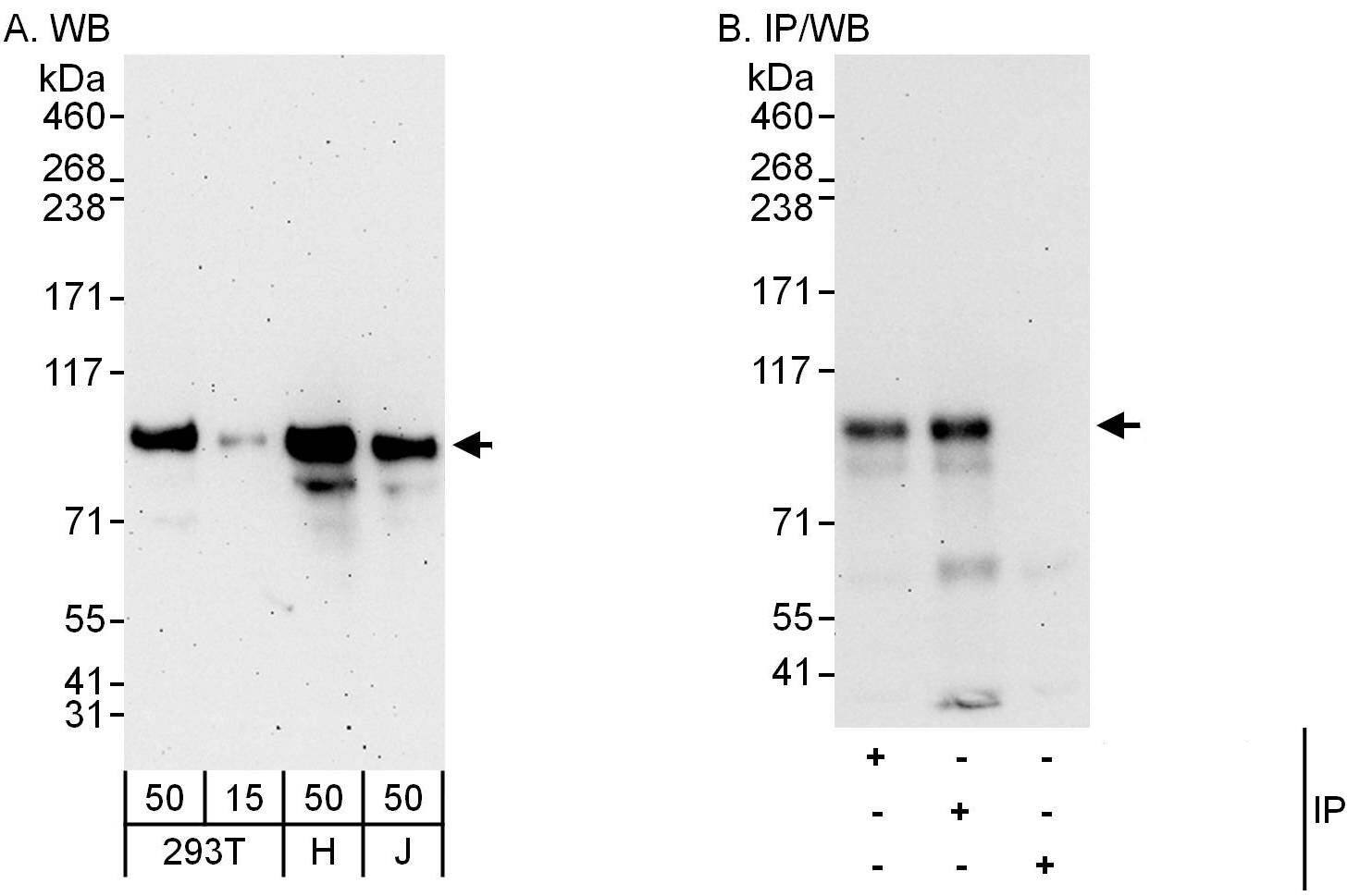 Western Blot APBB2 Antibody