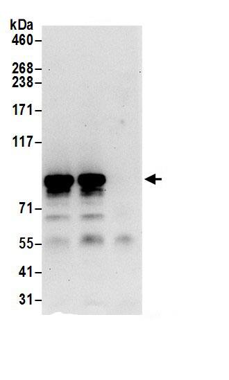 Immunoprecipitation:Mitofilin AntibodyNBP3-30256] -Detection of human IMMT by western blot of immunoprecipitates. Samples: Whole cell lysate (0.5 or 1.0 mg per IP reaction; 20% of IP loaded) from 293T cells prepared using NETN lysis buffer. Antibodies: Affinity purified rabbit anti-IMMT antibody NBP3-30256 (lot NBP3-30256-1) used for IP at 6 µg per reaction. IMMT was also immunoprecipitated by rabbit anti-IMMT.. For blotting immunoprecipitated IMMT, NBP3-30256 was used at 1 µg/ml. Detection: Chemiluminescence with an exposure time of 30 seconds.