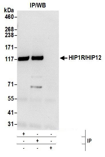Immunoprecipitation:[NBP3-30260]-Detection of human HIP1R/HIP12 by western blot of immunoprecipitates. Samples: Whole cell lysate from 293T cells prepared using NETN lysis buffer. Antibodies: Affinity purified rabbit anti-HIP1R/HIP12 antibody used for IP at 6 µg per reaction. HIP1R/HIP12 was also immunoprecipitated by rabbit anti-HIP1R/HIP12 antibody. For blotting immunoprecipitated HIP1R/HIP12, was used at 1 µg/ml. Detection: Chemiluminescence with an exposure time of 10 seconds.