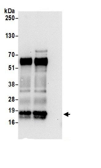 Immunoprecipitation:SZRD1 AntibodyNBP3-30261] -Detection of human SZRD1 by western blot of immunoprecipitates. Samples: Whole cell lysate (0.5 or 1.0 mg per IP reaction; 20% of IP loaded) from 293T cells prepared using NETN lysis buffer. Antibodies: Affinity purified rabbit anti-SZRD1 antibody NBP3-30261 (lot NBP3-30261-1) used for IP at 6 µg per reaction. SZRD1 was also immunoprecipitated by rabbit anti-SZRD1.. For blotting immunoprecipitated SZRD1, NBP3-30261 was used at 1 µg/ml. Detection: Chemiluminescence with an exposure time of 30 seconds.
