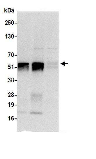 Immunoprecipitation:DUS2L AntibodyNBP3-30263] -Detection of human DUS2 by western blot of immunoprecipitates. Samples: Whole cell lysate (0.5 or 1.0 mg per IP reaction; 20% of IP loaded) from 293T cells prepared using NETN lysis buffer. Antibodies: Affinity purified rabbit anti-DUS2 antibody NBP3-30263 (lot NBP3-30263-1) used for IP at 6 µg per reaction. DUS2 was also immunoprecipitated by rabbit anti-DUS2 antibody for blotting immunoprecipitated DUS2, NBP3-30263 was used at 0.4 µg/ml. Detection: Chemiluminescence with an exposure time of 10 seconds.