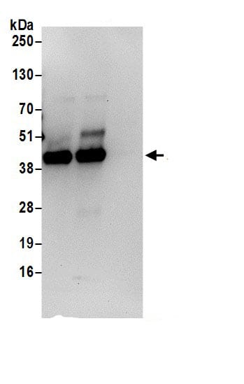 Immunoprecipitation:PCYT1A AntibodyNBP3-30266] -Detection of human PCYT1A by western blot of immunoprecipitates. Samples: Whole cell lysate (0.5 or 1.0 mg per IP reaction; 20% of IP loaded) from 293T cells prepared using NETN lysis buffer. Antibodies: Affinity purified rabbit anti-PCYT1A antibody NBP3-30266 (lot NBP3-30266-1) used for IP at 6 µg per reaction. PCYT1A was also immunoprecipitated by rabbit anti-PCYT1A.. For blotting immunoprecipitated PCYT1A, NBP3-30266 was used at 1 µg/ml. Detection: Chemiluminescence with an exposure time of 30 seconds.