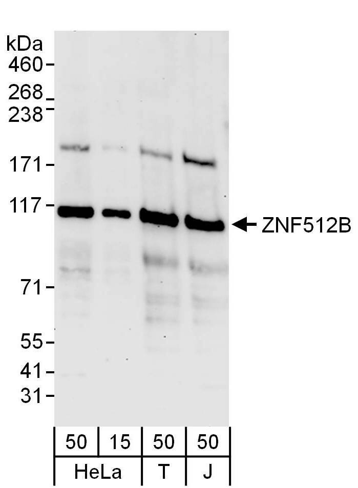 Western Blot:[NBP3-30269]-Detection of human ZNF512B by western blot. Samples: Whole cell lysate from HeLa , HEK293T and Jurkat cells. Antibodies: Affinity purified rabbit anti-ZNF512B antibody used for WB at 0. 1 µg/ml. Detection: Chemiluminescence with an exposure time of 3 minutes.