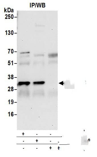 Immunoprecipitation:[NBP3-30271]-Detection of human CAPZB by western blot of immunoprecipitates. Samples: Whole cell lysate from 293T cells prepared using NETN lysis buffer. Antibodies: Affinity purified rabbit anti-CAPZB antibody used for IP at 6 µg per reaction. CAPZB was also immunoprecipitated by rabbit anti-CAPZB antibody. For blotting immunoprecipitated CAPZB, was used at 0. 4 µg/ml. Detection: Chemiluminescence with an exposure time of 30 seconds.