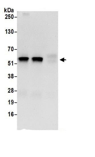 Immunoprecipitation:UDP glucose dehydrogenase AntibodyNBP3-30272] -Detection of human UGDH by western blot of immunoprecipitates. Samples: Whole cell lysate (0.5 or 1.0 mg per IP reaction; 20% of IP loaded) from 293T cells prepared using NETN lysis buffer. Antibodies: Affinity purified rabbit anti-UGDH antibody NBP3-30272 (lot NBP3-30272-1) used for IP at 6 µg per reaction. UGDH was also immunoprecipitated by rabbit anti-UGDH antibody BL18500. For blotting immunoprecipitated UGDH, NBP3-30272 was used at 0.4 µg/ml. Detection: Chemiluminescence with an exposure time of 10 seconds.