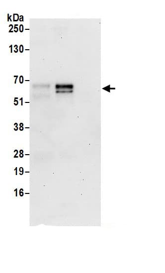 Immunoprecipitation:ATG13 AntibodyNBP3-30274] -Detection of human ATG13 by western blot of immunoprecipitates. Samples: Whole cell lysate (0.5 or 1.0 mg per IP reaction; 20% of IP loaded) from 293T cells prepared using NETN lysis buffer. Antibodies: Affinity purified rabbit anti-ATG13 antibody NBP3-30274 (lot NBP3-30274-1) used for IP at 6 µg per reaction. ATG13 was also immunoprecipitated by rabbit anti-ATG13 antibody BL20881. For blotting immunoprecipitated ATG13, NBP3-30274 was used at 1 µg/ml. Detection: Chemiluminescence with an exposure time of 30 seconds.