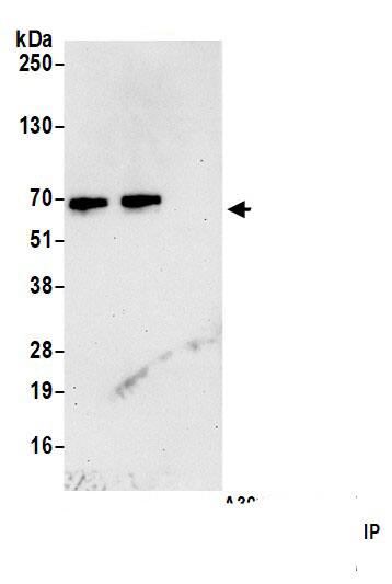 Immunoprecipitation:CARD9 AntibodyNBP3-30275] -Detection of human CARD9 by western blot of immunoprecipitates. Samples: Whole cell lysate (1.0 mg per IP reaction; 20% of IP loaded) from SW620 cells prepared using NETN lysis buffer. Antibodies: Affinity purified rabbit anti-CARD9 antibody (NBP3-30275 lot 2) used for IP at 1 µg per reaction. CARD9 was also immunoprecipitated by a previous lot of this antibody (lot NBP3-30275-1). For blotting immunoprecipitated CARD9, NBP3-30275 was used at 0.1 µg/ml. Detection: Chemiluminescence with an exposure time of 10 seconds.