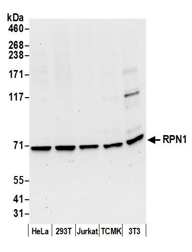 Western Blot:[NBP3-30277]-Detection of human and mouse RPN1 by western blot. Samples: Whole cell lysate from HeLa, HEK293T, Jurkat, mouse TCMK-1, and mouse NIH 3T3 cells prepared using NETN lysis buffer. Antibody: Affinity purified rabbit anti-RPN1 antibody used for WB at 0. 1 µg/ml. Detection: Chemiluminescence with an exposure time of 30 seconds.