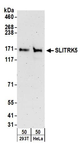 Western Blot:[NBP3-30284]-Detection of human SLITRK5 by western blot. Samples: Whole cell lysate from 293T and HeLa cells. Antibodies: Affinity purified rabbit anti-SLITRK5 antibody used for WB at 0. 4 µg/ml. Detection: Chemiluminescence with an exposure time of 3 minutes.