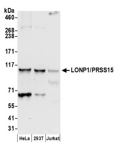 Western Blot:[NBP3-30286]-Detection of human LONP1/PRSS15 by western blot. Samples: Whole cell lysate from HeLa, HEK293T, and Jurkat cells prepared using NETN lysis buffer. Antibody: Affinity purified rabbit anti-LONP1/PRSS15 antibody used for WB at 0. 1 µg/ml. Detection: Chemiluminescence with an exposure time of 30 seconds.