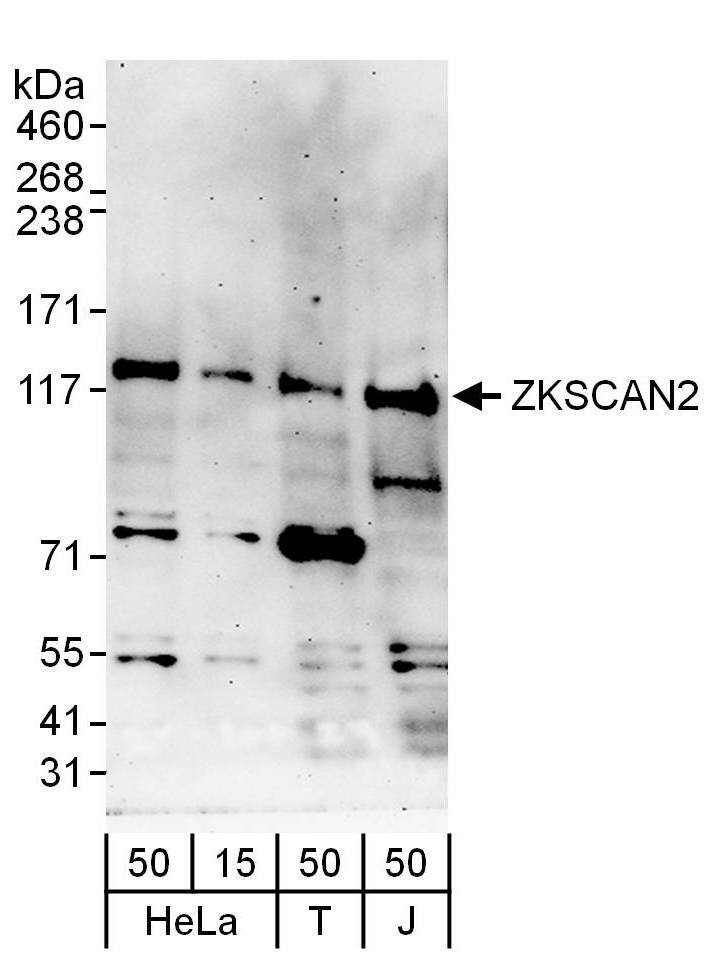 Western Blot:[NBP3-30287]-Detection of human ZKSCAN2 by western blot. Samples: Whole cell lysate from HeLa , HEK293T and Jurkat cells. Antibodies: Affinity purified rabbit anti-ZKSCAN2 antibody used for WB at 1 µg/ml. Detection: Chemiluminescence with an exposure time of 3 minutes.