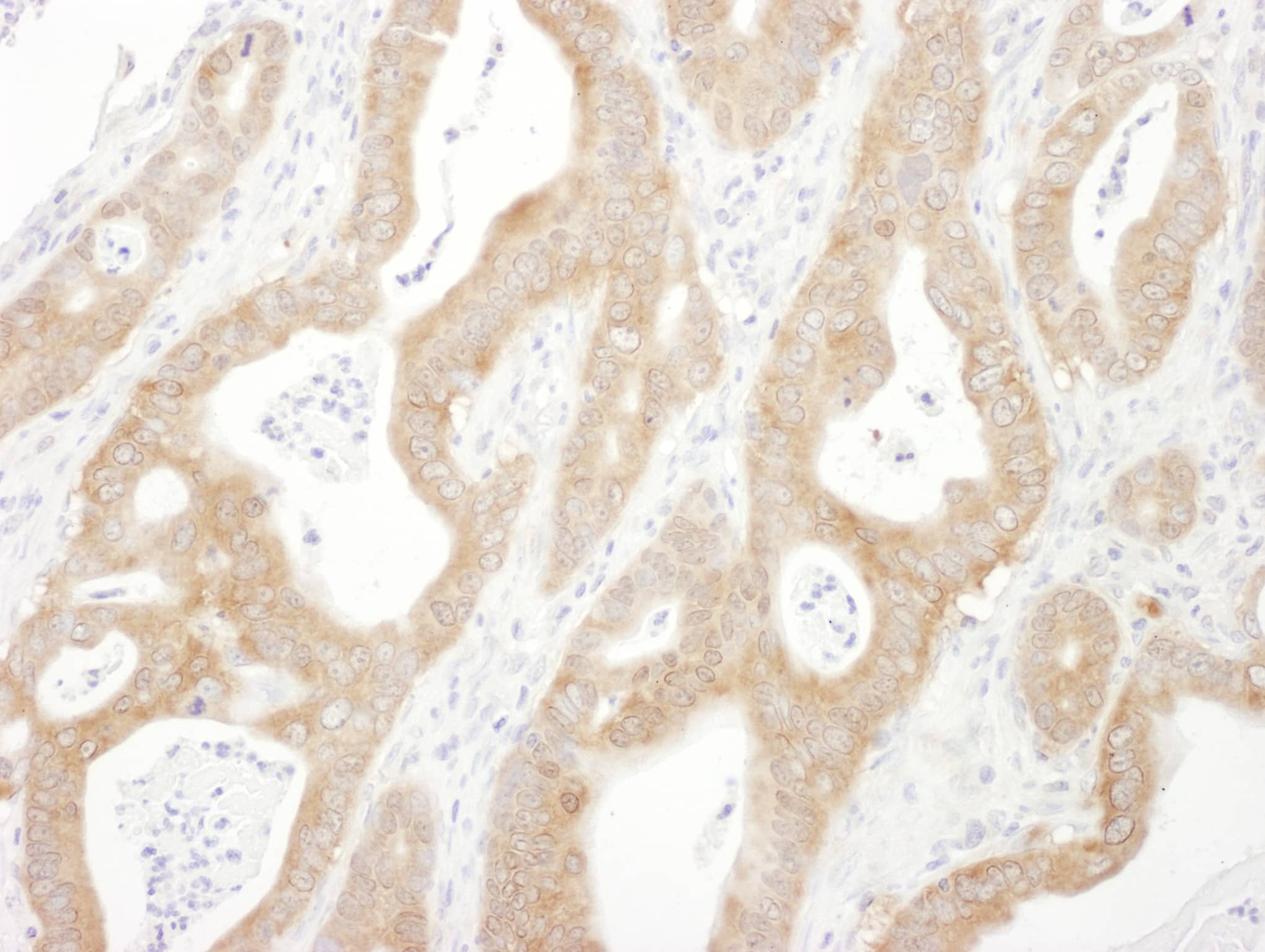 Immunohistochemistry beta-Arrestin 1 Antibody