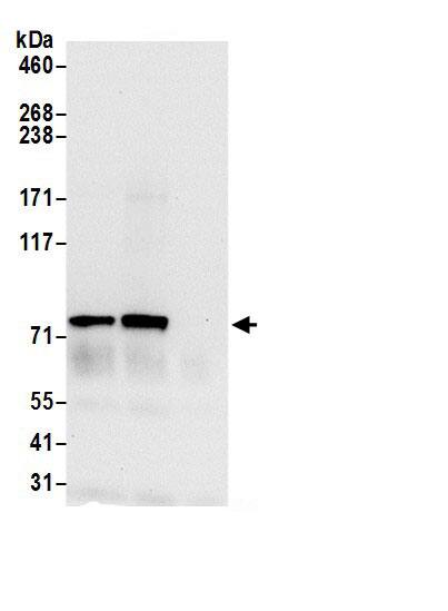 Immunoprecipitation:ALDH18A1 AntibodyNBP3-30292] -Detection of human ALDH18A1/P5CS by western blot of immunoprecipitates. Samples: Whole cell lysate (0.5 or 1.0 mg per IP reaction; 20% of IP loaded) from 293T cells prepared using NETN lysis buffer. Antibody: Affinity purified rabbit anti-ALDH18A1/P5CS antibody NBP3-30292 (lot NBP3-30292-1) used for IP at 6 µg per reaction. ALDH18A1/P5CS was also immunoprecipitated by rabbit anti-ALDH18A1/P5CS.. For blotting immunoprecipitated ALDH18A1/P5CS, NBP3-30292 was used at 0.4 µg/ml. Detection: Chemiluminescence with an exposure time of 10 seconds.